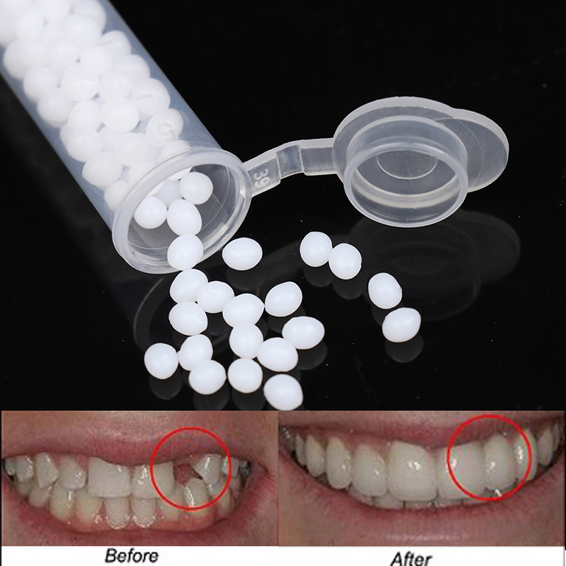 【K】1Box Temporary Tooth Repair - Teeth Whitening Kit review and price